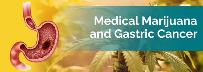 marijuana and gastric cancer