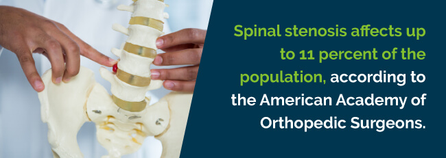 spinal stenosis rate