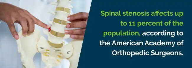 spinal stenosis rate