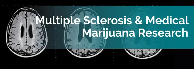 multiple sclerosis research