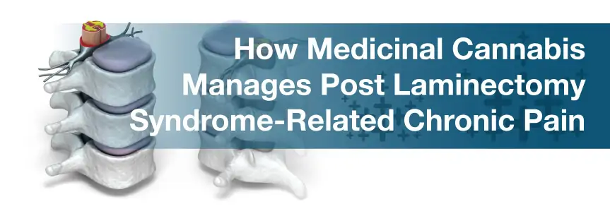 How Medicinal Cannabis Manages Post Laminectomy Syndrome-Related Chronic Pain