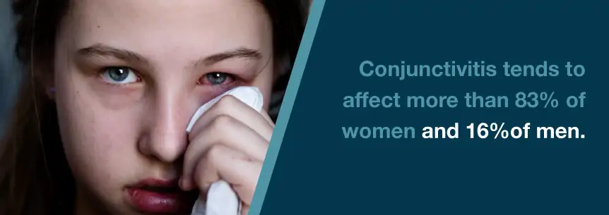 conjunctivitis stats