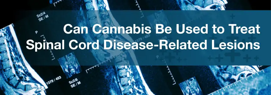 Can Cannabis Be Used to Treat Spinal Cord Disease-Related Lesions?