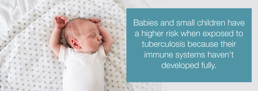 babies and tuberculosis