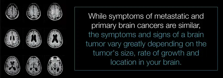 brain cancer symptoms