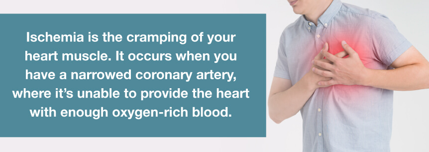 ischemia