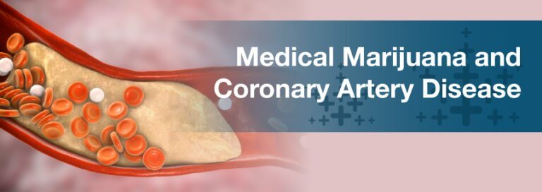 Coronary Artery Disease