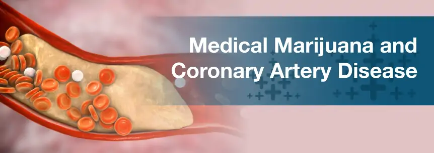marijuana coronary artery disease