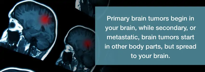 primary brain tumors