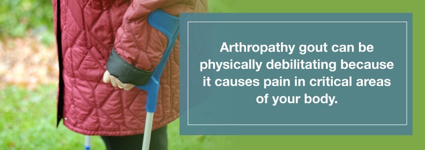 arthropathy gout pain