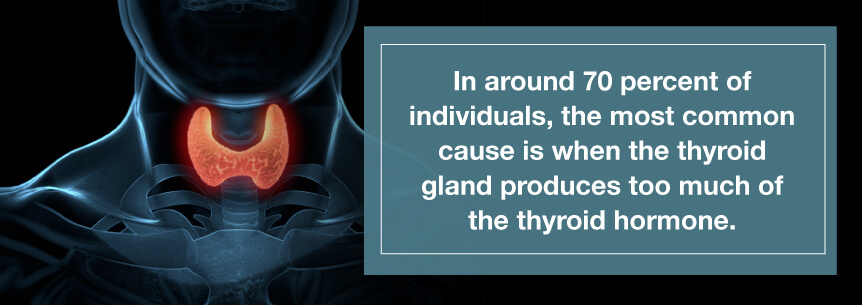 hyperthyroidism cause