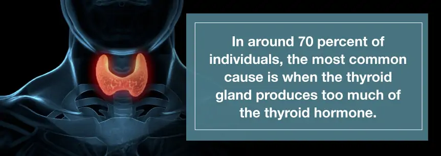 hyperthyroidism cause