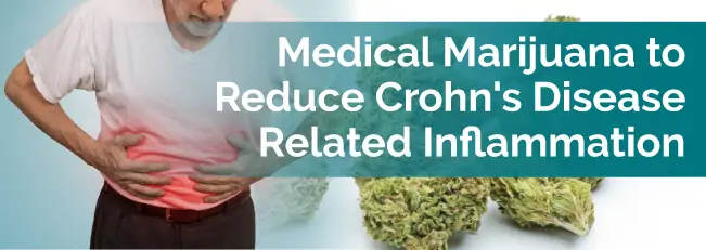 Medical Marijuana to Reduce Crohn's Disease Related Inflammation