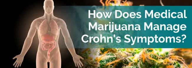 How Does Medical Marijuana Manage Crohn's Symptoms