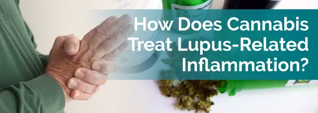 How Does Cannabis Treat Lupus-Related Inflammation