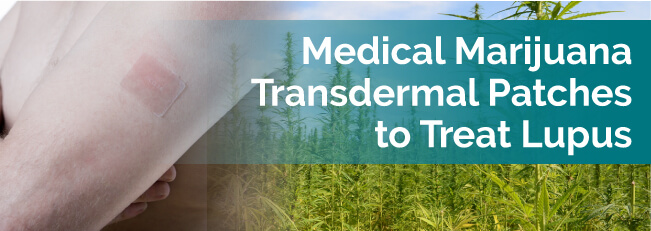 Medical Marijuana Transdermal Patches to Treat Lupus