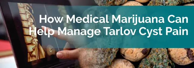 How Medical Marijuana Can Help Manage Tarlov Cyst Pain