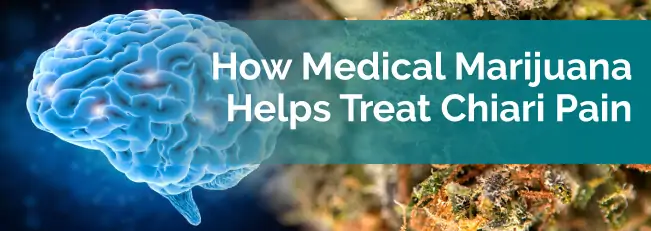 How Medical Marijuana Helps Treat Chiari Pain