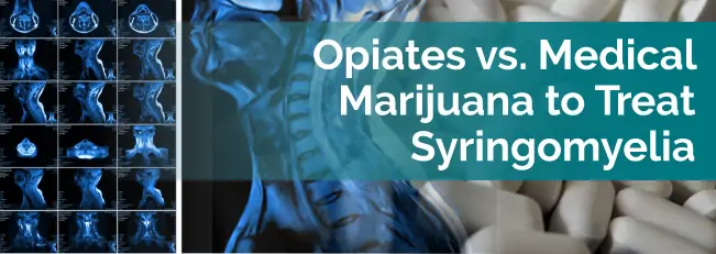 Opiates vs. Medical Marijuana to Treat Syringomyelia