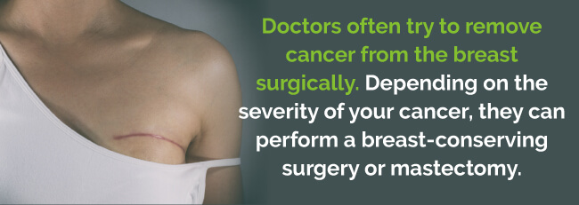 breast surgery