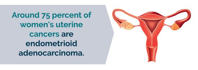 different types of uterine cancer