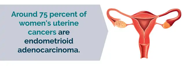 endometrioid