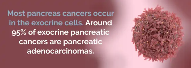 pancreas cancers occur in the exocrine cells