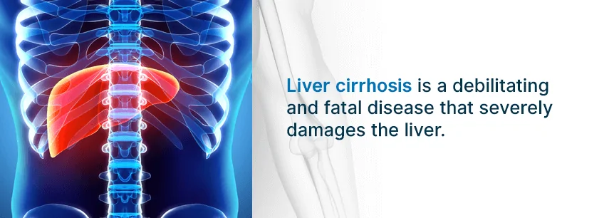 liver cirrhosis