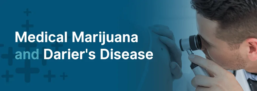 marijuana and darier disease