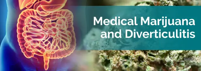 medical marijuana and diverticulitis