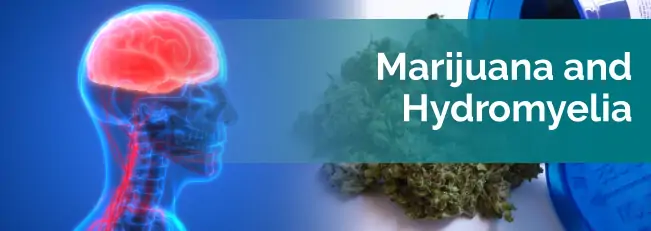 Marijuana and Hydromyelia