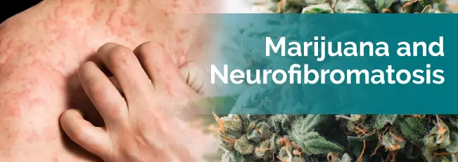 Marijuana and Neurofibromatosis