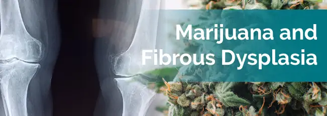Marijuana and Fibrous Dysplasia