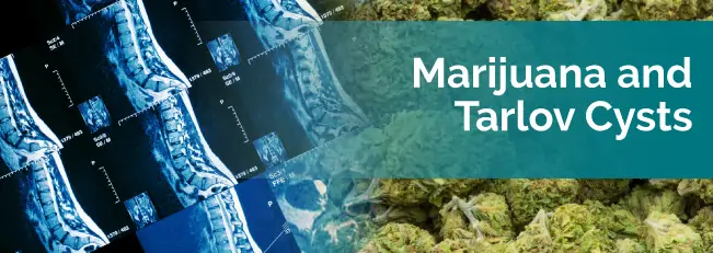 Marijuana and Tarlov Cysts