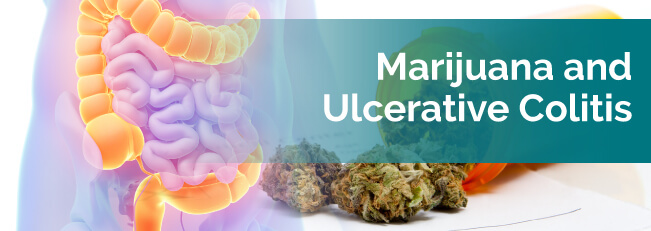 marijuana for ulcerative colitis
