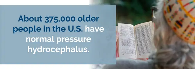 Hydrocephalus Stats