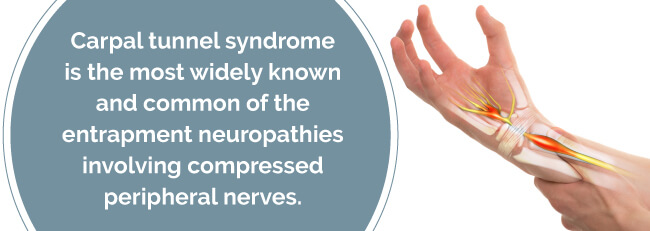 what is carpal tunnel syndrome