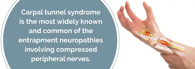 what is carpal tunnel syndrome