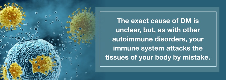 cause of dermatomyositis