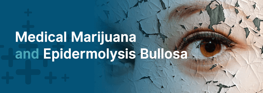 marijuana for epidermolysis bullosa