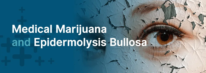 marijuana for epidermolysis bullosa