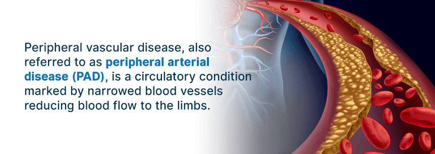 peripheral arterial disease