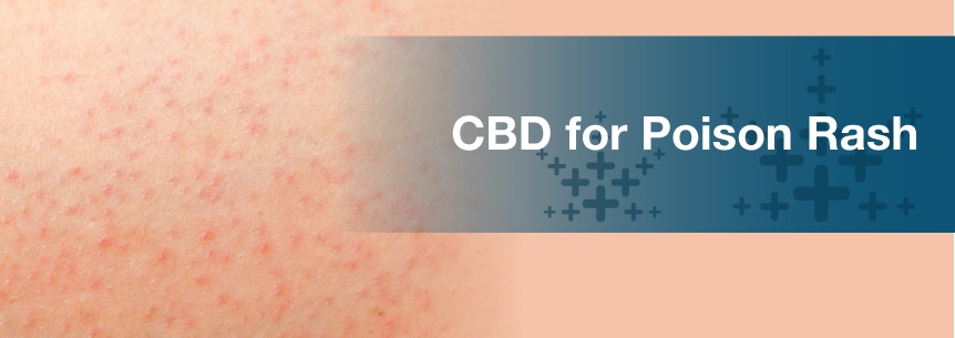 cbd for poison