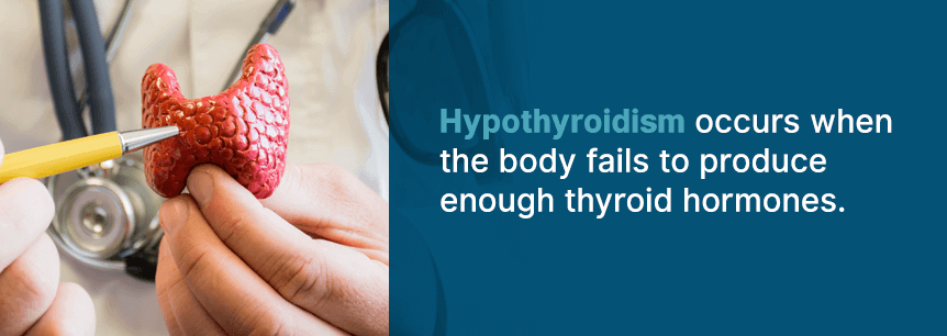 hypothyroidism causes