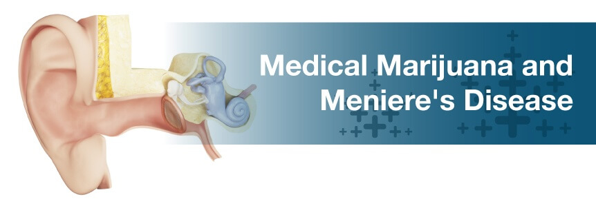 Meniere’s Disease