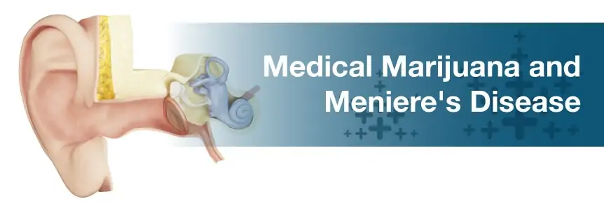 Meniere’s Disease