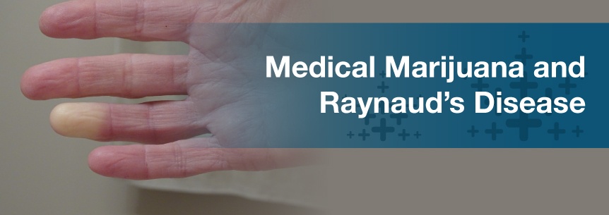 marijuana for raynauds