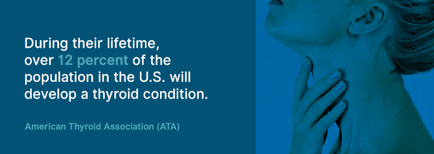 thyroid disease statistics