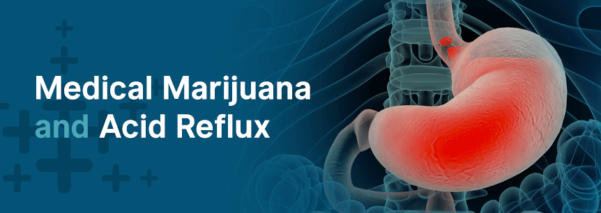 Medical Cannabis as an Acid Reflux Treatment