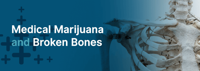 Broken Bones